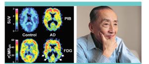 Guide maisons de retraite seniors et personnes agées : Une chaire axée sur le recherche sur la Maladie d'Alzheimer